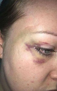 monokl na obličeji Britky Hannah Jamesové, která se přestěhovala do Bahrajnu za manželem Jassimem Alhadderem